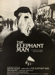 elephant_man_david_lynch_wikicine_streaming_cinepedia_boutique
